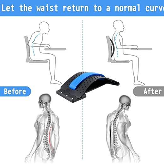 Multi-Level Back Stretcher for Posture & Pain Relief (Blue)